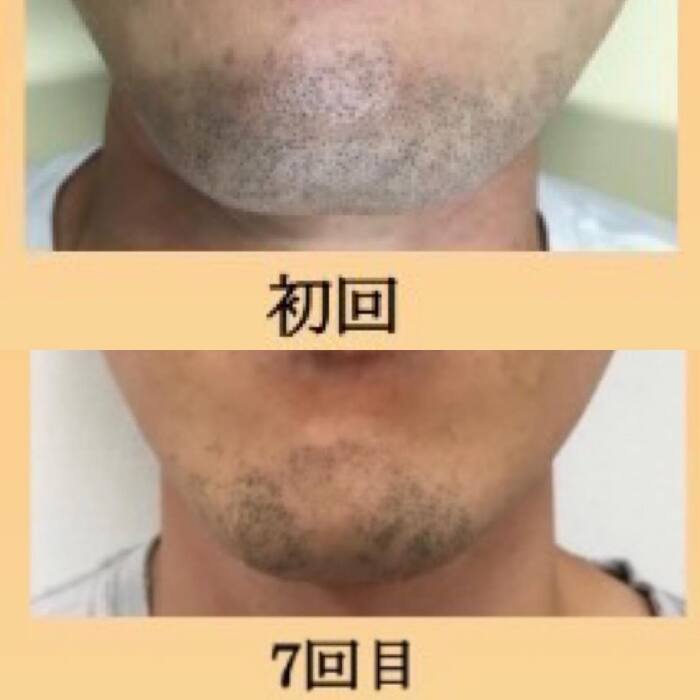 画像316